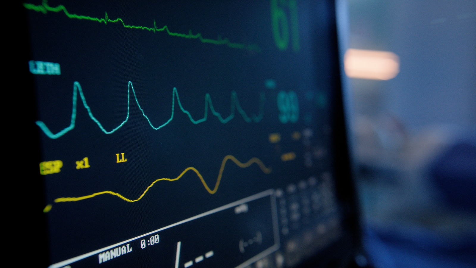 EKG-maskine